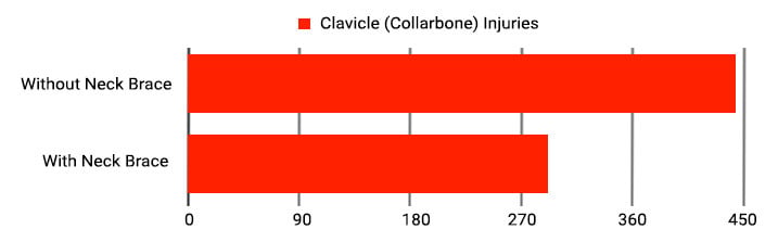 Collarbone Injuries Statistics